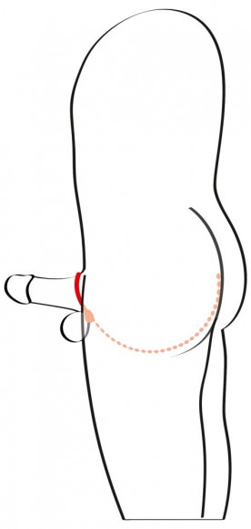 Эрекционное кольцо с цепочкой для стимуляции ягодиц